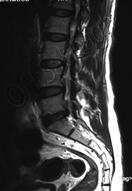 Case Report – 23