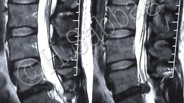 Case Report – 25
