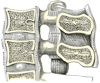 Mechanisms involved in Intervertebral Disc Injury